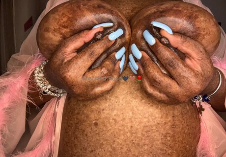 Freckledfantasy5