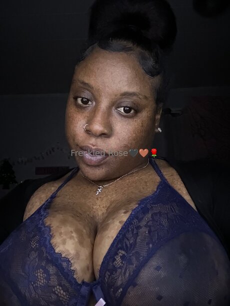 Freckledfantasy5
