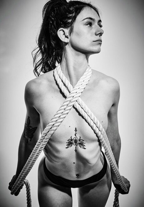 Ropebite