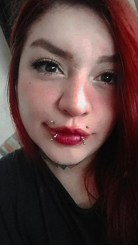 Cherry Degeneration