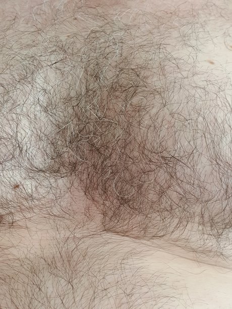 Nacktes geleaktes OnlyFans-Foto von Harry Mann
