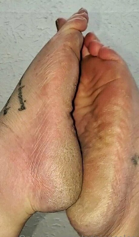 Erinjensoles