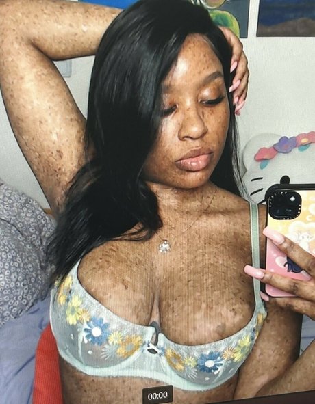 Freckledn