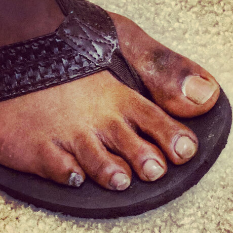 Thefootfanatic