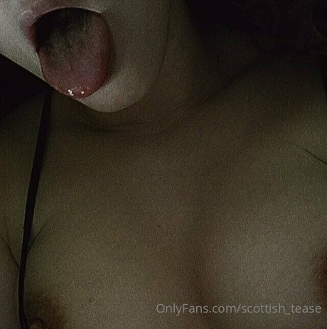 Scottishtease