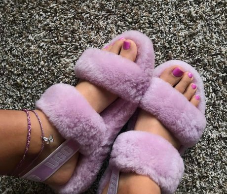 Herathletefeet