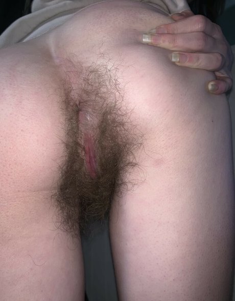 Hairy Women