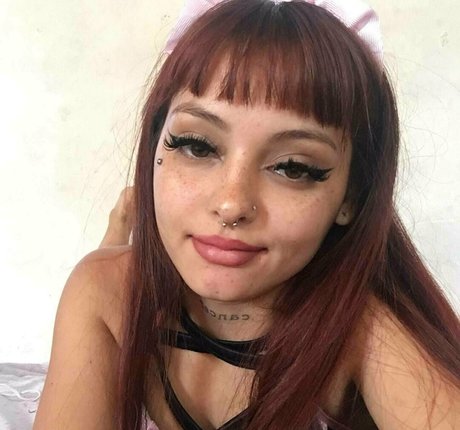 Sofisfreckles
