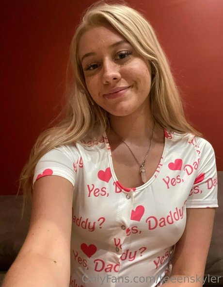 Skyler Storm